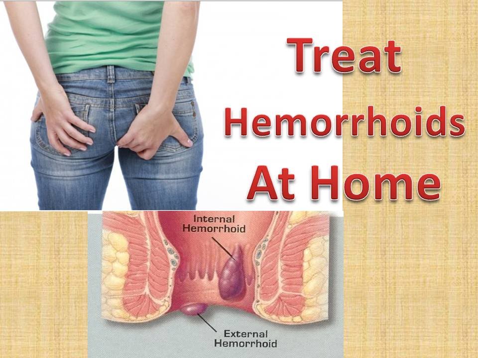 Harmonizing Hemorrhoids: Insights from Traditional Chinese Medicine and the Healing Power of Frequency and Sound Therapy